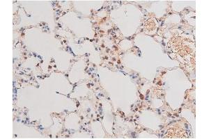 ABIN6267487 at 1/200 staining Rat lung tissue sections by IHC-P.