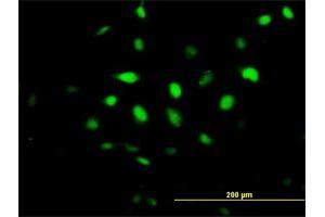 Immunofluorescence of purified MaxPab antibody to BCCIP on HeLa cell.