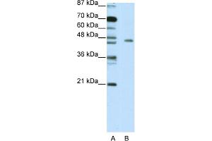 WB Suggested Anti-MINA Antibody Titration:  5. (MINA anticorps  (C-Term))