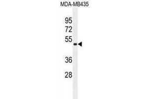 TAPT1 Antibody (C-term) western blot analysis in MDA-MB435 cell line lysates (35ug/lane). (TAPT1 anticorps  (C-Term))