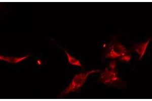 ABIN6275053 staining HeLa cells by IF/ICC. (DOCK1 anticorps  (C-Term))