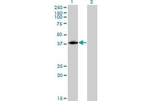 Western Blot analysis of ISL2 expression in transfected 293T cell line by ISL2 monoclonal antibody (M03), clone 1D9. (ISL2 anticorps  (AA 261-358))