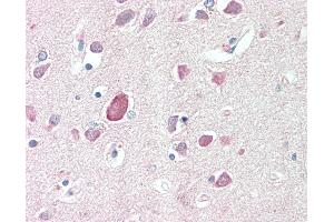 Anti-PTGDS / PGDS antibody IHC staining of human brain, cortex. (PTGDS anticorps  (AA 27-38))