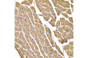Immunohistochemistry of paraffin-embedded mouse heart using SLC2A4 antibody (ABIN5995371) at dilution of 1/100 (40x lens). (GLUT4 anticorps)
