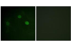 Immunofluorescence analysis of COS7 cells, using CDK1 (Phospho-Thr14) antibody. (CDK1 anticorps  (pThr14))