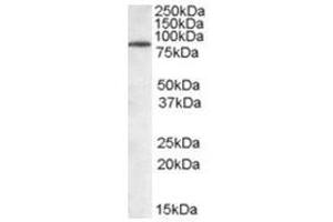 Image no. 1 for anti-Tripartite Motif Containing 3 (TRIM3) (N-Term) antibody (ABIN374306) (TRIM3 anticorps  (N-Term))