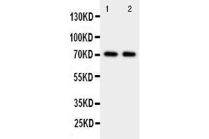 Anti-Prolactin Receptor antibody, Western blotting Lane 1: HELA Cell Lysate Lane 2: MCF-7 Cell Lysate