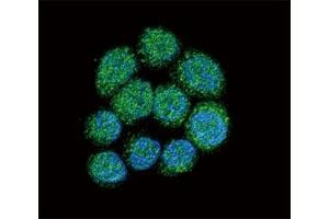 Confocal immunofluorescent analysis of BTK antibody with 293 cells followed by Alexa Fluor 488-conjugated goat anti-rabbit lgG (green).