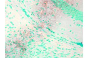 KCNQ1 Immunohistochemistry.