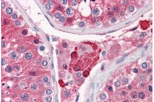 Human Testis: Formalin-Fixed, Paraffin-Embedded (FFPE)