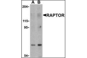 Western blot analysis of Raptor in L1210 cell lysate with this product at (A) 2 and (B) 4 μg/ml. (RAPTOR anticorps  (N-Term))