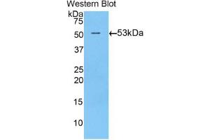 Western blot analysis of the recombinant protein. (TGM1 anticorps  (AA 504-737))