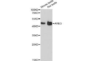 Western blot analysis of extracts of various cell lines, using AREG antibody (ABIN6290061) at 1:3000 dilution. (Amphiregulin anticorps)