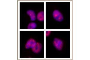SMARCA2 / BRM antibody (mAb) tested by Immunofluorescence.