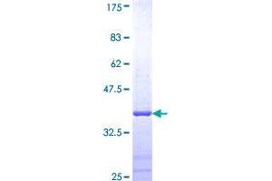 Image no. 1 for Clusterin (CLU) (AA 402-501) protein (GST tag) (ABIN1349762)