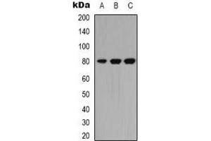 Western blot analysis of PKC theta expression in A549 (A), Hela (B), Jurkat (C) whole cell lysates. (PKC theta anticorps  (C-Term))