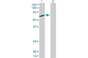 Western Blot analysis of NEK11 expression in transfected 293T cell line by NEK11 monoclonal antibody (M01), clone 4E1-1F4.