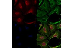 ABIN7094698 and ABIN7098749 staining  cells by IF/ICC.