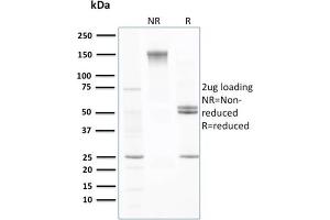 SDS-PAGE Analysis Purified Transthyretin Mouse Monoclonal Antibody (CPTC-TTR-1). (TTR anticorps)