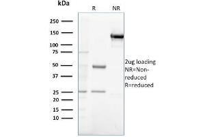 SDS-PAGE Analysis Purified Gastrin Mouse Monoclonal Antibody (GAST/2632). (Gastrin anticorps)