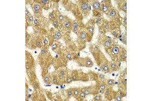 Immunohistochemistry of paraffin-embedded human liver injury using MYO1C antibody at dilution of 1:100 (x40 lens). (Myosin IC anticorps)