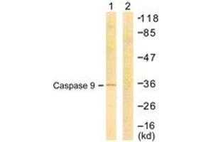 Western blot analysis of extracts from COS7 cells, treated with Etoposide 25uM 24h, using Caspase 9 (Ab-144) Antibody. (Caspase 9 anticorps  (AA 110-159))