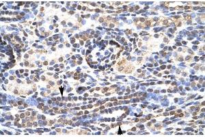 Rabbit Anti-KL9 Antibody  Paraffin Embedded Tissue: Human Kidney Cellular Data: Epithelial cells of renal tubule Antibody Concentration: 4. (KLF9 anticorps  (N-Term))