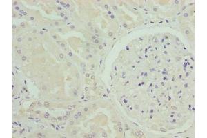 Immunohistochemistry of paraffin-embedded human kidney tissue using ABIN7161010 at dilution of 1:100 (NADPH Oxidase 4 anticorps  (AA 210-424))
