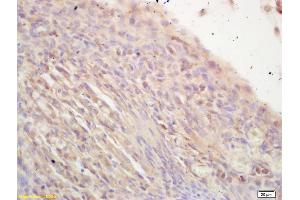 Formalin-fixed and paraffin embedded mouse embryo labeled with Rabbit Anti NR2C2/TAK1 Polyclonal Antibody, Unconjugated (ABIN707846) at 1:200 followed by conjugation to the secondary antibody and DAB staining