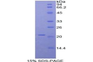 SDS-PAGE analysis of Mouse ADAMTS12 Protein.