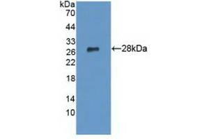 Detection of Recombinant LYPLA1, Human using Polyclonal Antibody to Lysophospholipase I (LYPLA1) (LYPLA1 anticorps  (AA 1-230))