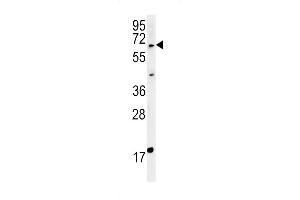 anti-Makorin Ring Finger Protein 3 (MKRN3) (AA 160-189) antibody