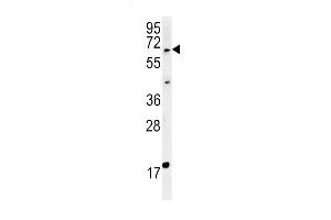 MKRN3 Antibody (Center) (ABIN651835 and ABIN2840417) western blot analysis in MDA-MB435cell line lysates (15 μg/lane). (MKRN3 anticorps  (AA 160-189))