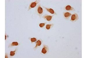 Immunocytochemistry analysis of ABIN7139147 diluted at 1:5 and staining in Hela cells (treated with 30mM sodium butyrate for 4h) performed on a Leica BondTM system.