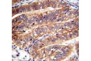 NUMB antibody immunohistochemistry analysis in formalin fixed and paraffin embedded human uterus tissue.