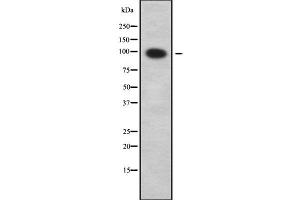 Western blot analysis SLC9A2 using COLO205 whole cell lysates (SLC9A2 anticorps  (Internal Region))