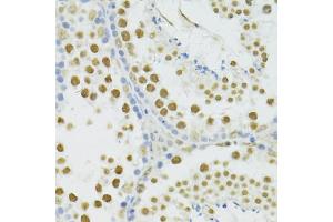 Immunohistochemistry of paraffin-embedded mouse testis using BRCA1 antibody (ABIN5997316) at dilution of 1/100 (40x lens).