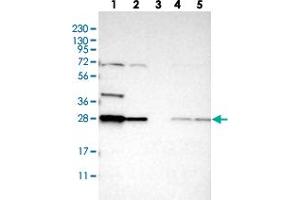Western blot analysis of Lane 1: RT-4, Lane 2: U-251 MG, Lane 3: Human Plasma, Lane 4: Liver, Lane 5: Tonsil with BPGM polyclonal antibody  at 1:250-1:500 dilution.