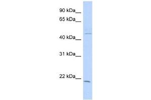CIB3 antibody used at 1 ug/ml to detect target protein. (CIB3 anticorps  (N-Term))