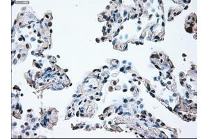 Image no. 16 for anti-B-Raf proto-oncogene, serine/threonine kinase (BRAF) antibody (ABIN1496961)