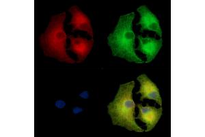 ABIN7097181 and ABIN7101249 staining  cells by IF/ICC. (LRGUK anticorps)