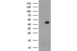 Image no. 1 for anti-LIM Homeobox 1 (LHX1) (AA 100-362) antibody (ABIN1490805) (LHX1 anticorps  (AA 100-362))