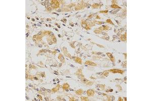 Immunohistochemistry of paraffin-embedded human stomach using OLR1 antibody at dilution of 1:200 (x400 lens). (OLR1 anticorps  (AA 58-273))