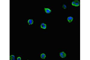 Immunofluorescent analysis of MCF-7 cells using ABIN7156219 at dilution of 1:100 and Alexa Fluor 488-congugated AffiniPure Goat Anti-Rabbit IgG(H+L)