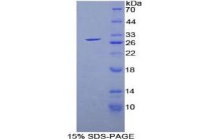 SDS-PAGE of Protein Standard from the Kit (Highly purified E.