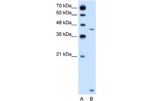 anti-Solute Carrier Family 46, Member 3 (SLC46A3) (N-Term) antibody
