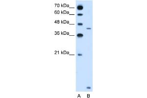 WB Suggested Anti-SLC46A3 Antibody Titration:  2. (SLC46A3 anticorps  (N-Term))
