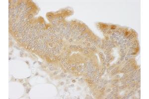 Immunohistochemistry (IHC) image for anti-N-Myc (And STAT) Interactor (NMI) (C-Term) antibody (ABIN7448693)
