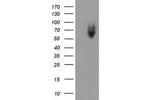 Western Blotting (WB) image for anti-Kelch-Like ECH-Associated Protein 1 (KEAP1) antibody (ABIN1499015) (KEAP1 anticorps)