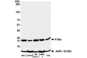 Western Blotting (WB) image for anti-HRas proto-oncogene, GTPase (HRAS) (AA 50-100) antibody (ABIN7795737)